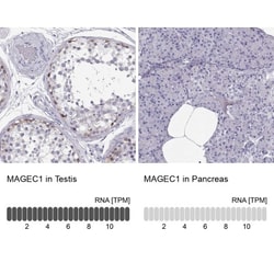 MAGEC1 Antibody, Novus Biologicals:Antibodies:Primary Antibodies